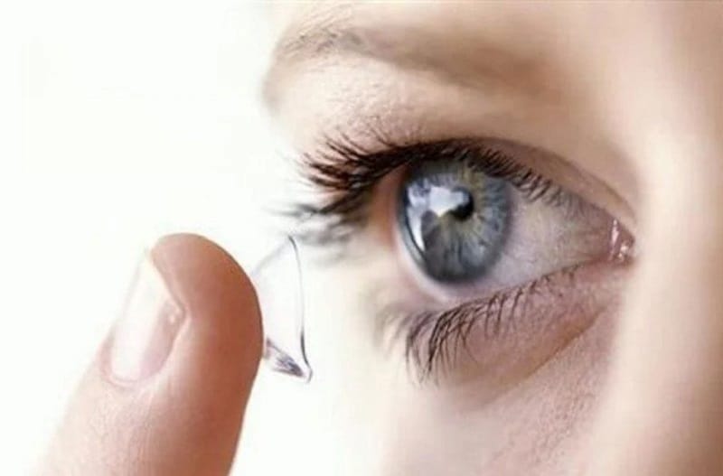 Contact lenses should be avoided during early recovery until the eyelids have healed sufficiently.