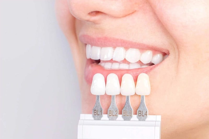 Bọc răng sứ đúng cách sẽ không gây ảnh hưởng đến răng thật