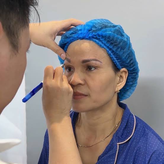 Through this rigorous and professional approach, Kangnam guarantees natural-looking results.