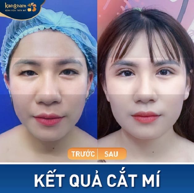 Đôi mắt to tròn, cân xứng với gương mặt