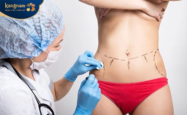 After the procedure, the abdomen appears flatter and smoother, with visibly reduced loose and wrinkled skin.