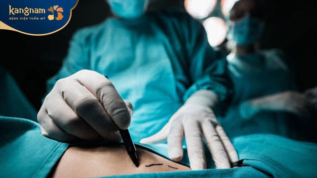 The surgeon will make the incision precisely along the pre-marked surgical line.