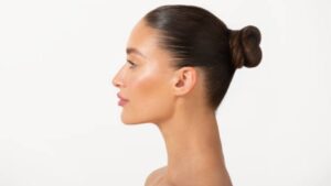Cartilage-Wrapped Rhinoplasty: Protecting the Nasal Tip