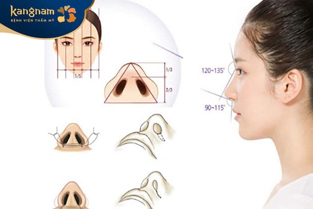 Đây là phương pháp cần kỹ năng cao và kinh nghiệm từ bác sĩ thẩm mỹ