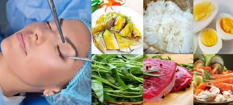 You should avoid eating water spinach, eggs, beef, and seafood after eyelid surgery.