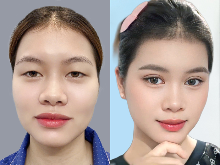 naturally beautiful eyelids
