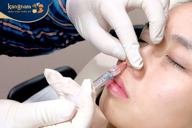 The duration of nose filler depends partly on the quality and type of filler used.