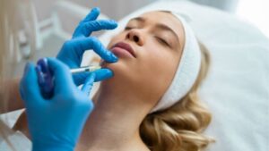 Chin Filler: A Sharper Chin Without Surgery