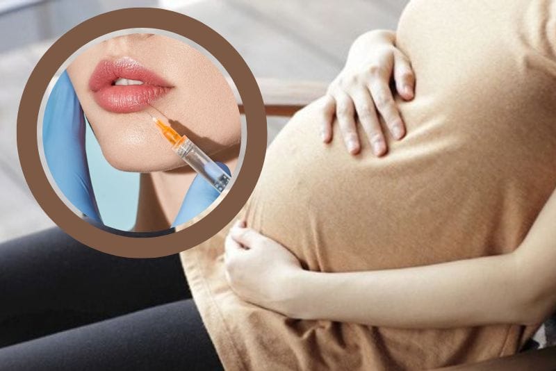 Pregnant women should avoid dermal filler injections.