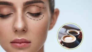 Can You Drink Coffee After Eyelid Surgery?
