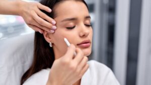 Collagen Thread Lift: Youthful Skin Without Surgery