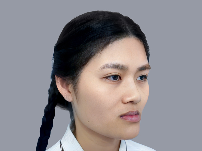 A plow-shaped face is characterized by a lower jaw extending further outward
