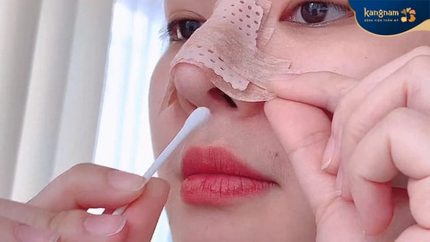 Careful postoperative care supports a smoother recovery and a more stable nasal shape.