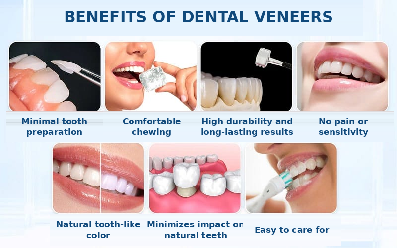 Porcelain veneers minimize tooth reduction, improve masticatory function, and maintain long-lasting results