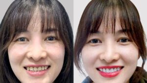Cosmetic Dentistry Services at Kangnam
