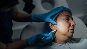 How Long to Follow a Diet After a Facelift?