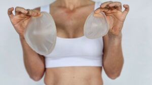 Are Breast Implants Permanent (see main article)