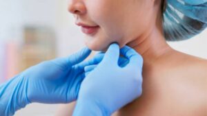 Double Chin Liposuction: A Slim, Defined V-Line Jaw