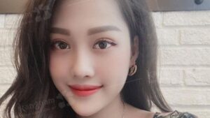 Under-Eye Bag Removal (Eyelid Fat Removal)