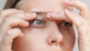 Essential Aftercare Tips After Eyelid Surgery
