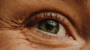 Will You Need to Redo Eyelid Surgery When You’re Older?