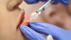 How Much Does a Filler-Dissolving Injection Cost?