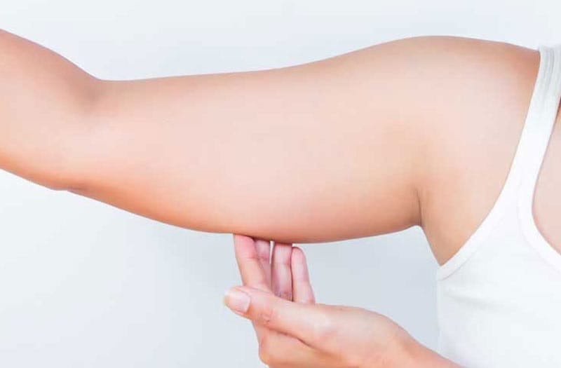 Losing arm fat in 1 week can help firm the skin but is not visibly effective