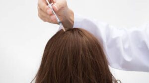 How Much Does Hair-Growth Mesotherapy Cost?