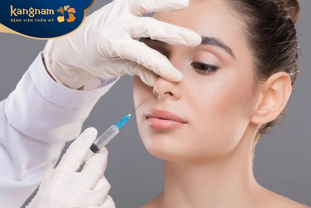 Tiêm chất làm đầy mũi ngày càng trở thành phương pháp làm đẹp phổ biến