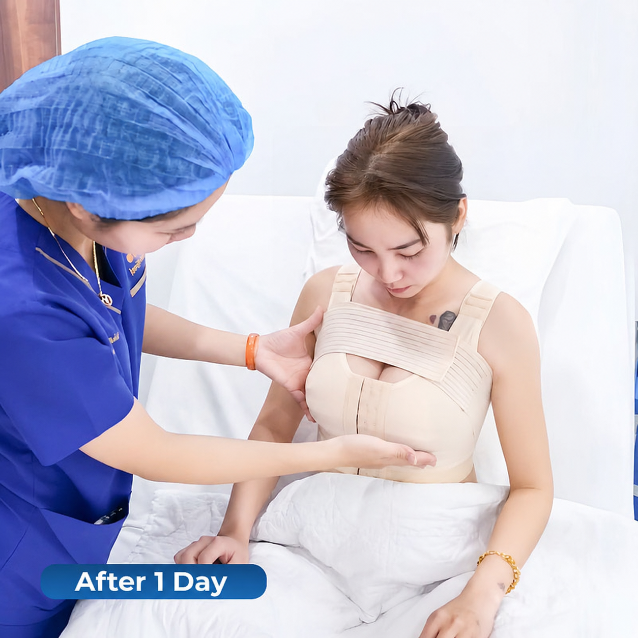 Avoiding sleeping on your side immediately post-surgery helps the bustline stabilize