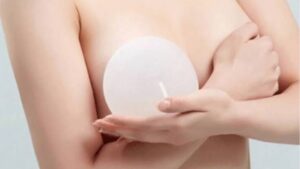 How Long Does Breast Augmentation Take to Heal?