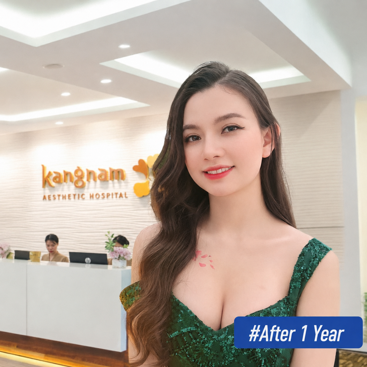 Breast augmentation typically comes with long-term warranty policies