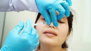 How Long Does Nose Filler Last?