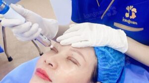 How Long Does Facial Contouring Surgery Take to Recover?