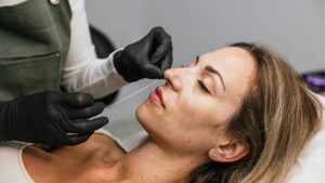 How Long Does Thread Lift Rhinoplasty Last?