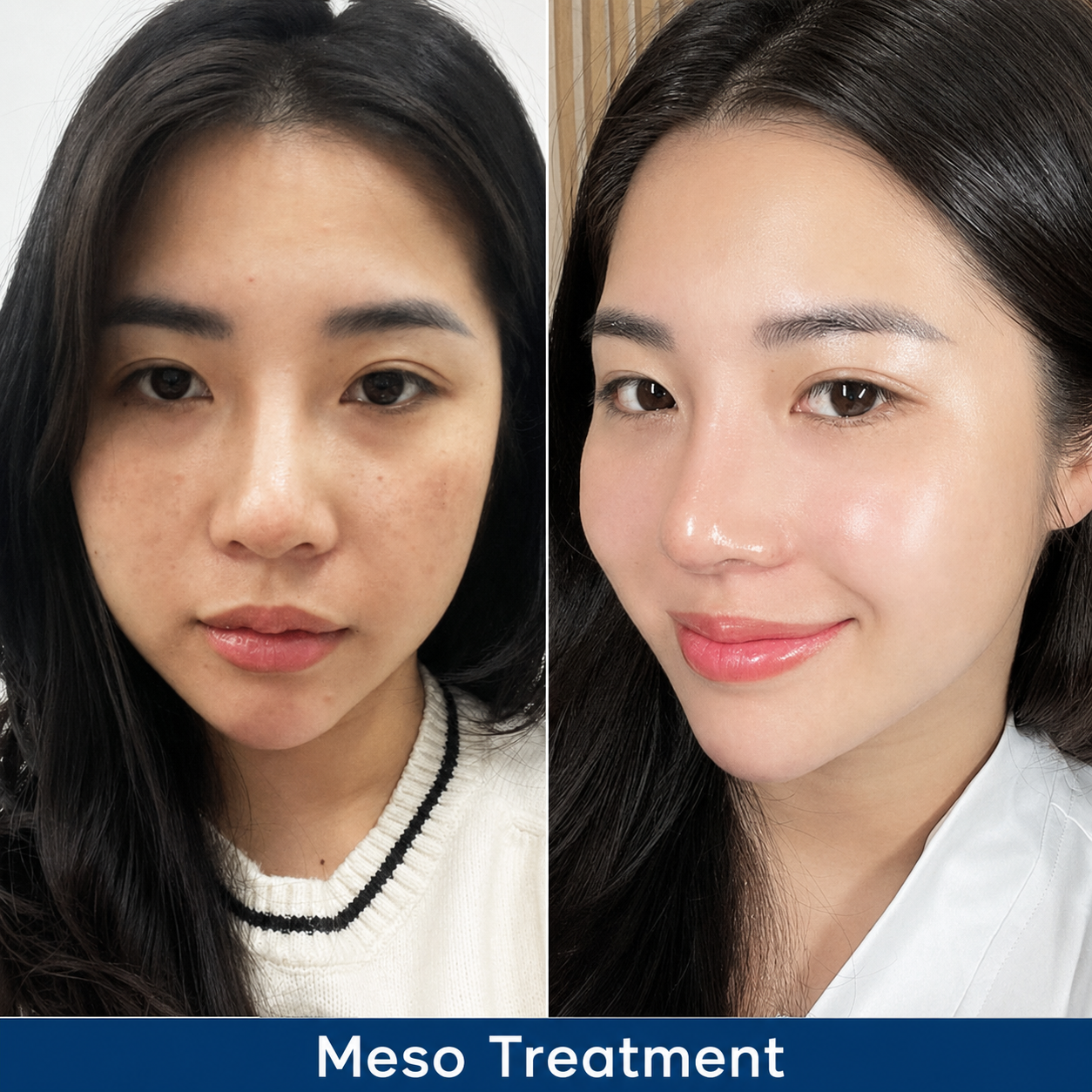 Skin with multiple concerns or deeper damage may require more time to respond to the treatment.