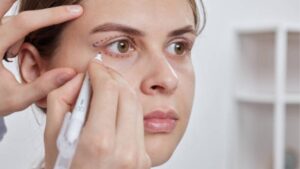 How Many Years Does Eyelid Surgery Last?