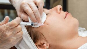 How Often Should You Get Mesotherapy?