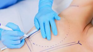 Is Breast Augmentation Safe (see main article)