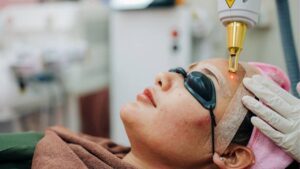 How Much Does Laser Treatment for Dark Scars Cost?