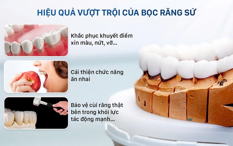 Bọc răng sứ giúp khắc phục những khuyết điểm về màu sắc, nứt, vỡ