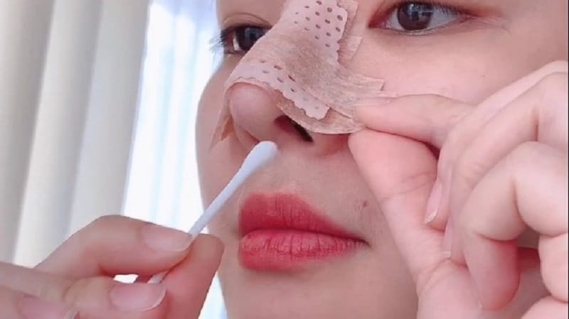 Clean the nose daily with sterile saline as instructed.