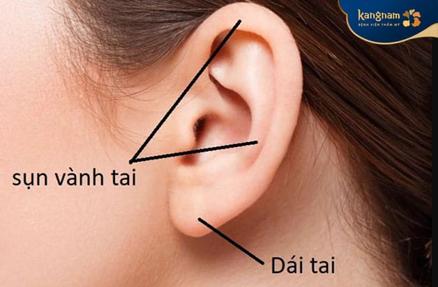 Cartilage taken from the ear is used to cover the nasal tip.