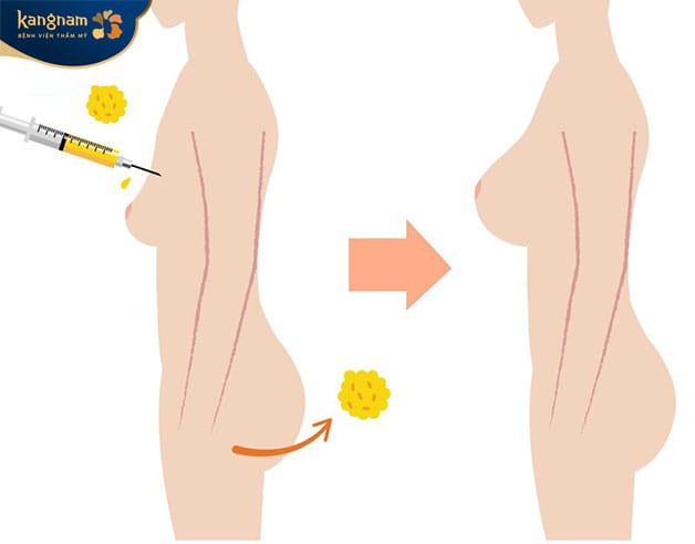 This method is completely compatible with the body and does not cause reactions