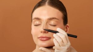 Nasal Tip Refinement (see Nasal Tip Reduction)