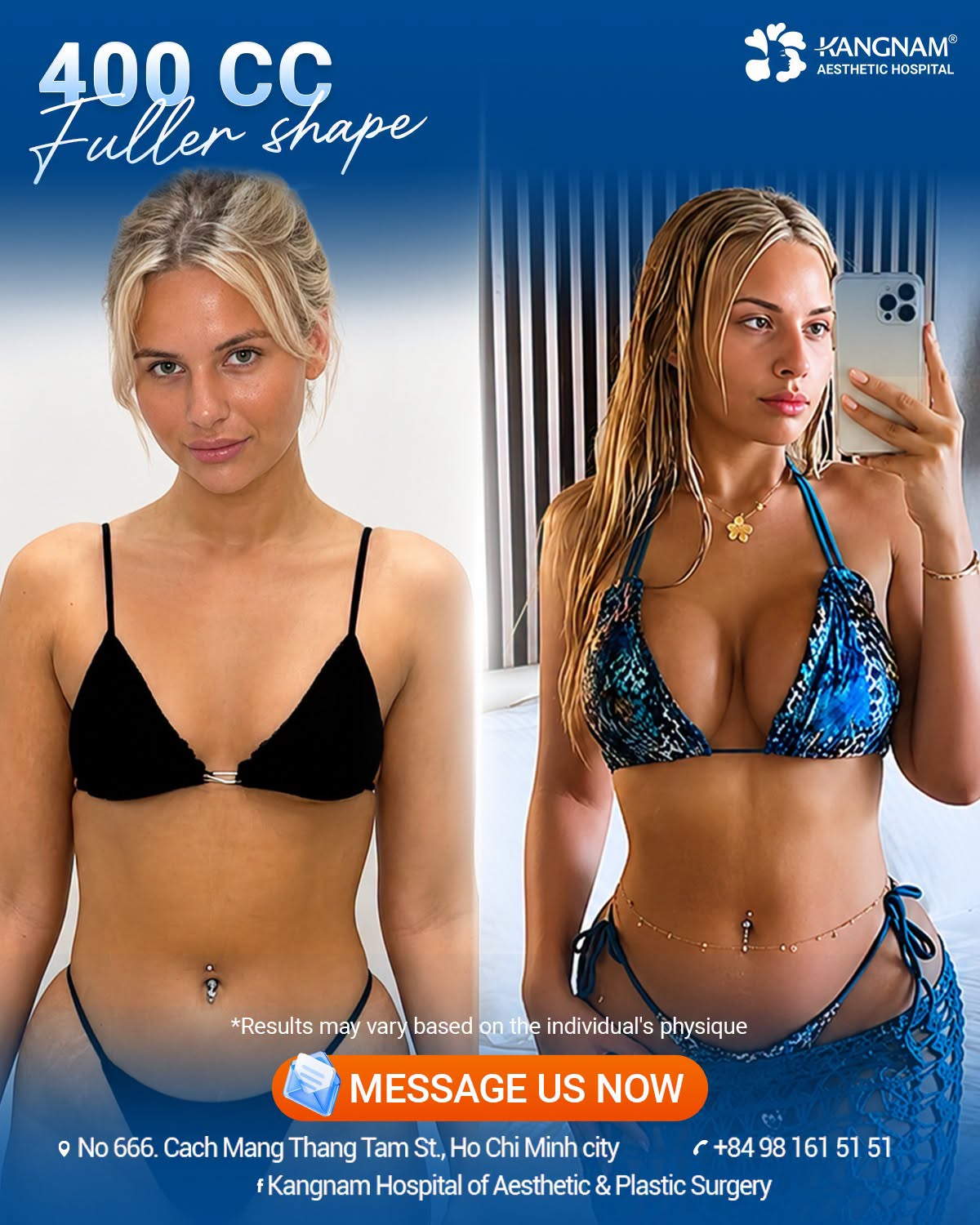 Breast augmentation at Kangnam: quick recovery and natural-looking results. 