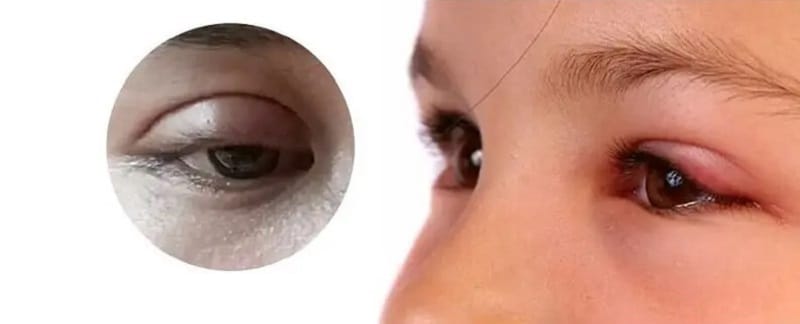 Applying makeup too early may irritate the eyelids and increase the risk of infection.