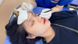 How Much Does Suture Removal for Eyelid Tucking Cost?