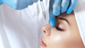 Nose Filler Injection: A Non-Surgical Nose Reshape