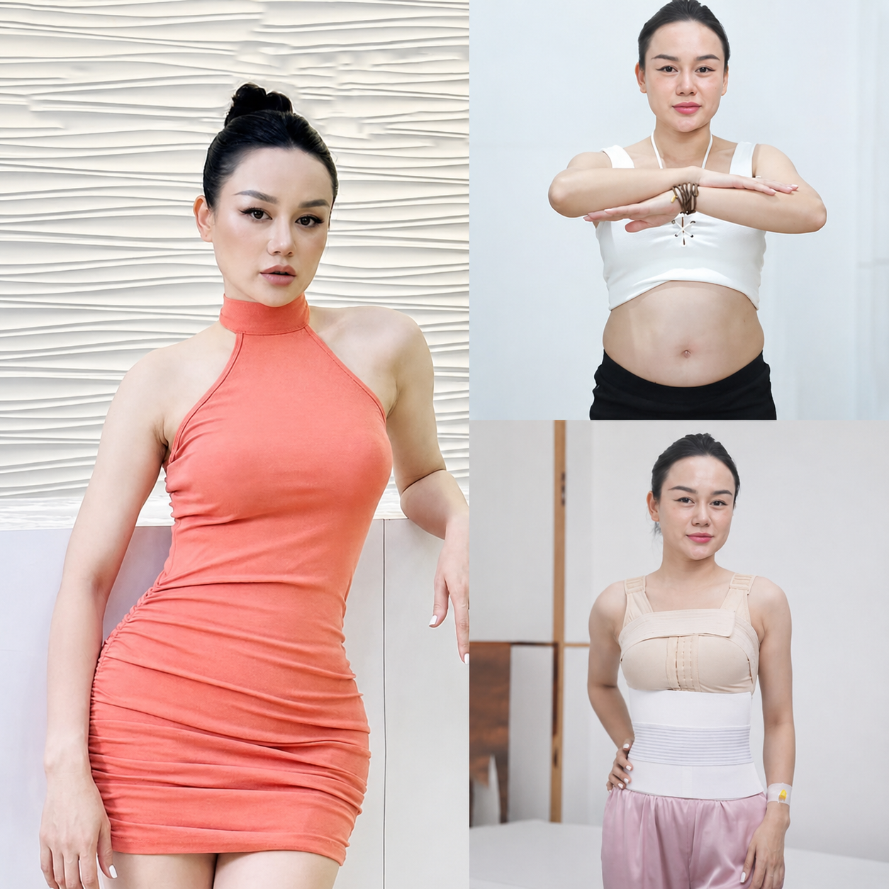 Wearing a compression binder helps the abdomen quickly take shape